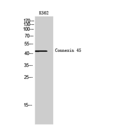 Western Blot - Anti-GJC1 Antibody (C15880) - Antibodies.com
