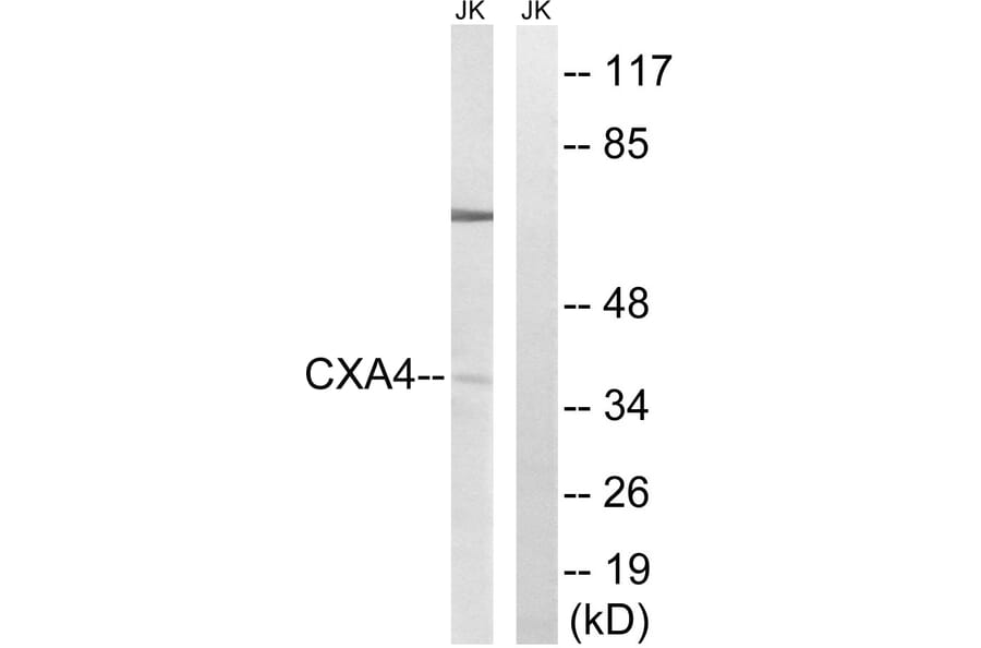 Western Blot - Anti-GJA4 Antibody (C15878) - Antibodies.com