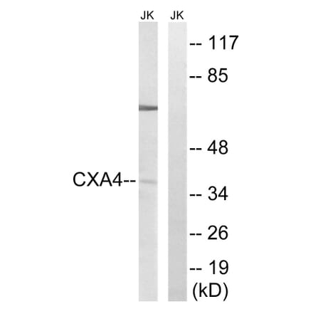 Western Blot - Anti-GJA4 Antibody (C15878) - Antibodies.com