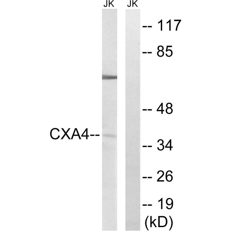 Western Blot - Anti-GJA4 Antibody (C15878) - Antibodies.com