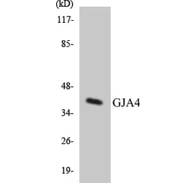 Western Blot - Anti-GJA4 Antibody (R12-2811) - Antibodies.com