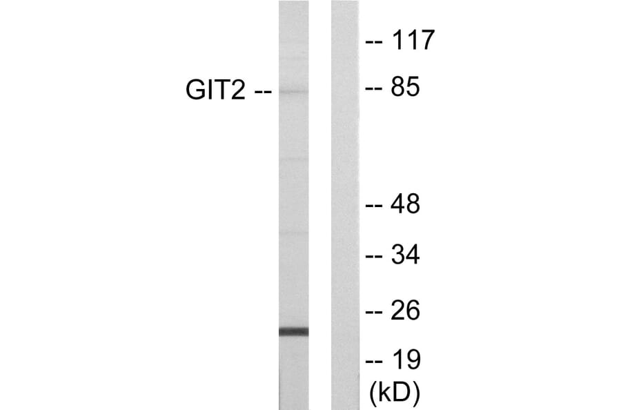 Western Blot - Anti-GIT2 Antibody (C11019) - Antibodies.com