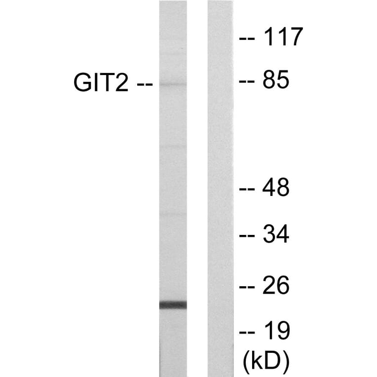 Western Blot - Anti-GIT2 Antibody (C11019) - Antibodies.com