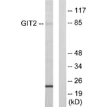 Western Blot - Anti-GIT2 Antibody (C11019) - Antibodies.com