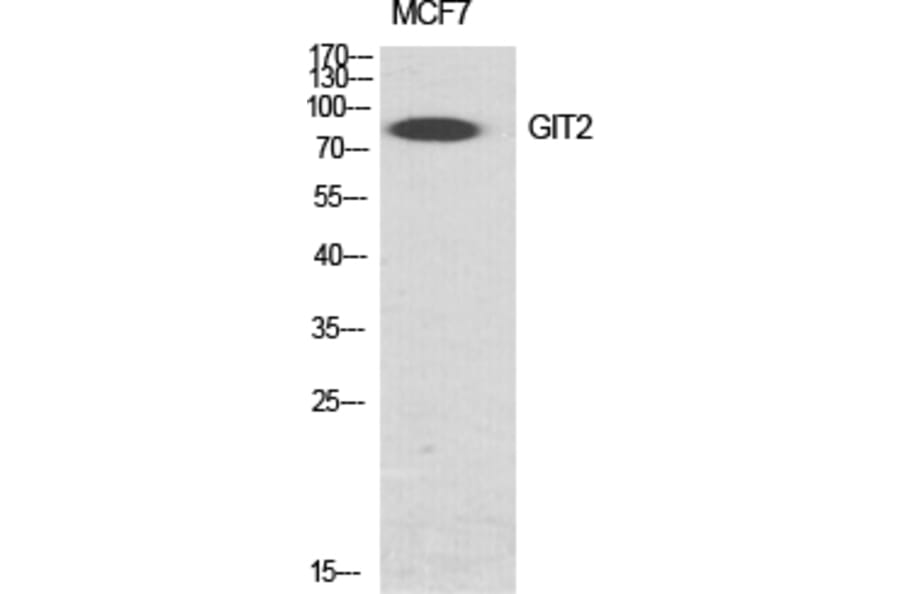 Western Blot - Anti-GIT2 Antibody (C11019) - Antibodies.com
