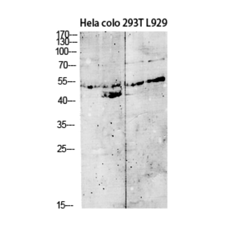 Western Blot - Anti-GDF9 Antibody (C30625) - Antibodies.com