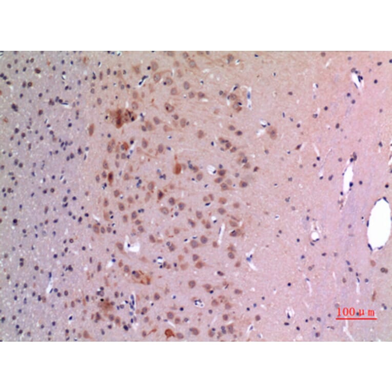 Immunohistochemistry - Anti-GDF5 Antibody (C30650) - Antibodies.com