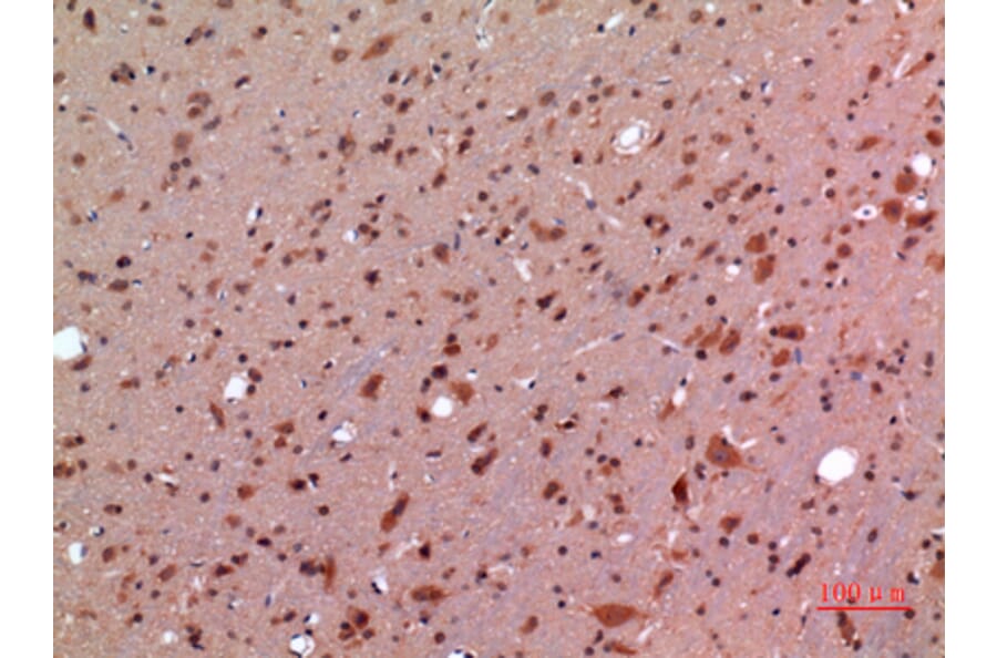 Immunohistochemistry - Anti-GDF5 Antibody (C30650) - Antibodies.com