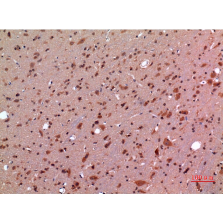 Immunohistochemistry - Anti-GDF5 Antibody (C30650) - Antibodies.com