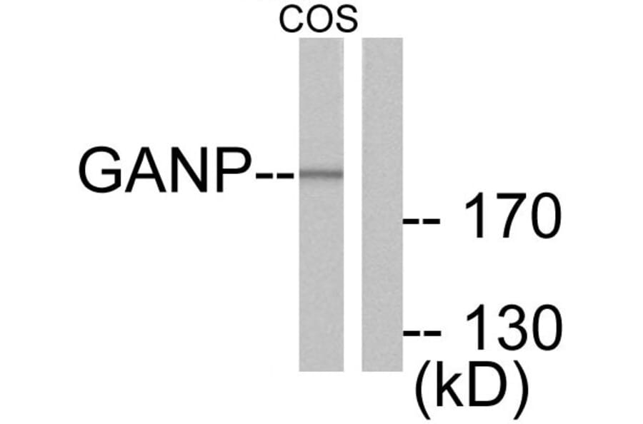 Western Blot - Anti-GANP Antibody (C0204) - Antibodies.com