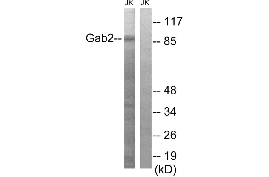 Western Blot - Anti-Gab2 Antibody (B8349) - Antibodies.com