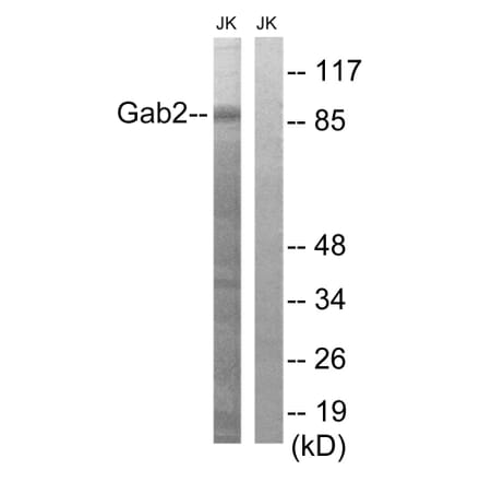Western Blot - Anti-Gab2 Antibody (B8349) - Antibodies.com