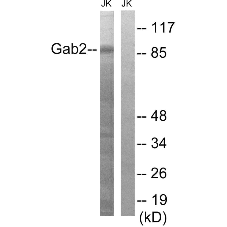 Western Blot - Anti-Gab2 Antibody (B8349) - Antibodies.com