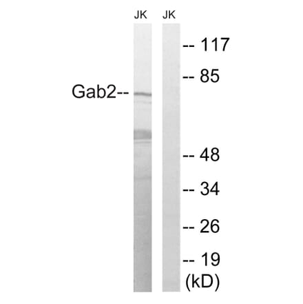 Western Blot - Anti-Gab2 Antibody (B8350) - Antibodies.com