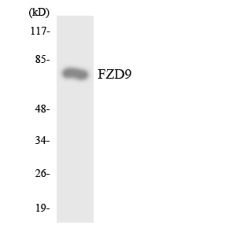 Western Blot - Anti-FZD9 Antibody (R12-2789) - Antibodies.com