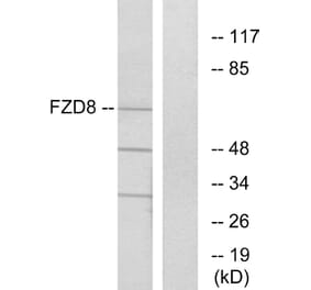 Western Blot - Anti-FZD8 Antibody (G261) - Antibodies.com