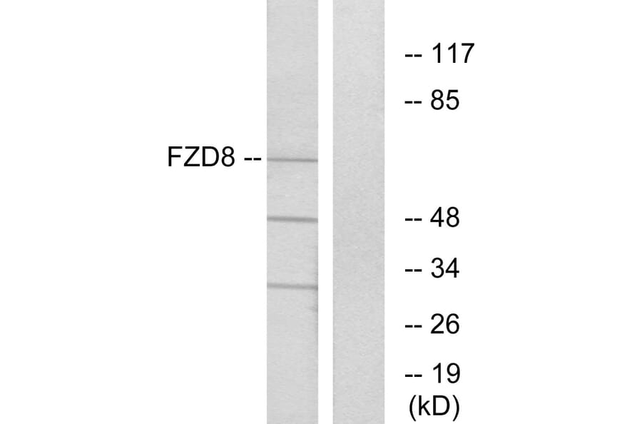 Western Blot - Anti-FZD8 Antibody (G261) - Antibodies.com