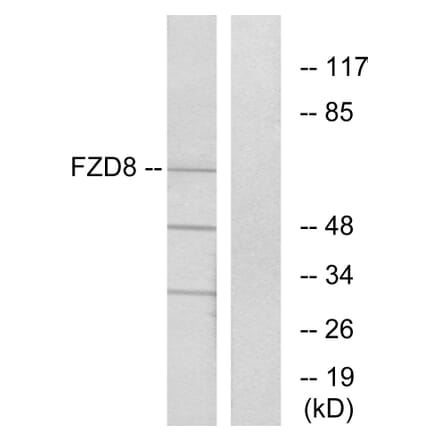 Western Blot - Anti-FZD8 Antibody (G261) - Antibodies.com