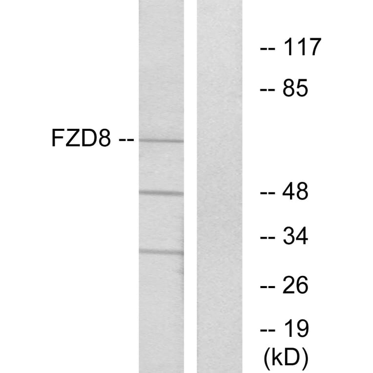 Western Blot - Anti-FZD8 Antibody (G261) - Antibodies.com
