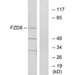 Western Blot - Anti-FZD8 Antibody (G261) - Antibodies.com