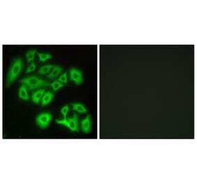 Immunofluorescence - Anti-FZD4 Antibody (G109) - Antibodies.com