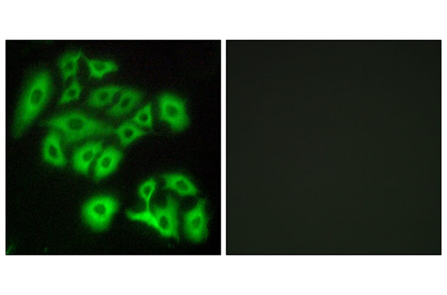 Immunofluorescence - Anti-FZD4 Antibody (G109) - Antibodies.com