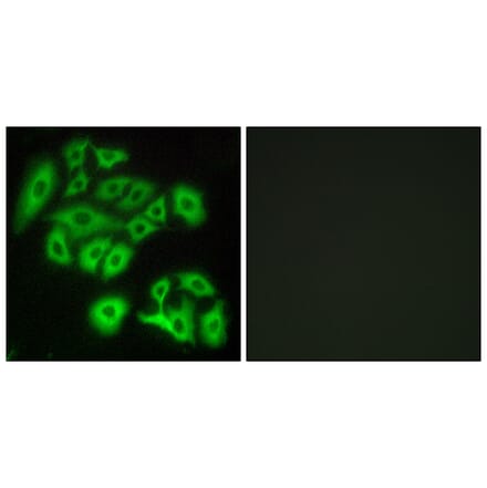 Immunofluorescence - Anti-FZD4 Antibody (G109) - Antibodies.com