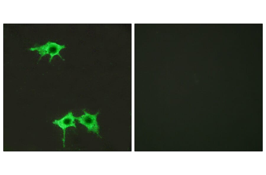 Immunofluorescence - Anti-FZD4 Antibody (G258) - Antibodies.com