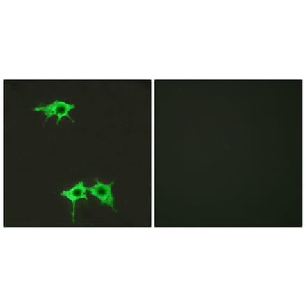 Immunofluorescence - Anti-FZD4 Antibody (G258) - Antibodies.com