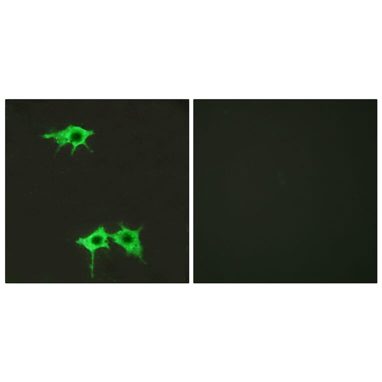 Immunofluorescence - Anti-FZD4 Antibody (G258) - Antibodies.com