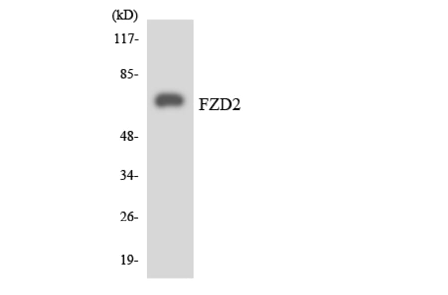 Western Blot - Anti-FZD2 Antibody (R12-2783) - Antibodies.com
