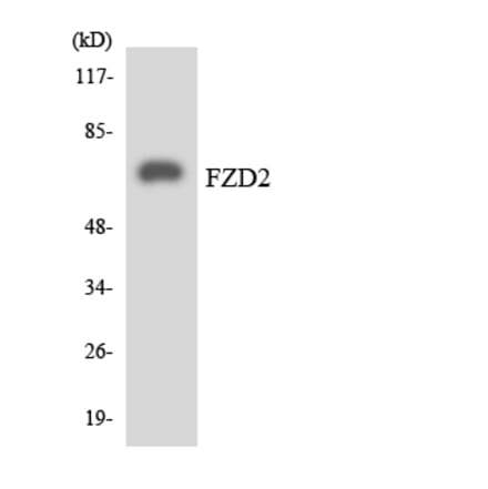 Western Blot - Anti-FZD2 Antibody (R12-2783) - Antibodies.com