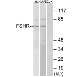 Western Blot - Anti-FSHR Antibody (G253) - Antibodies.com