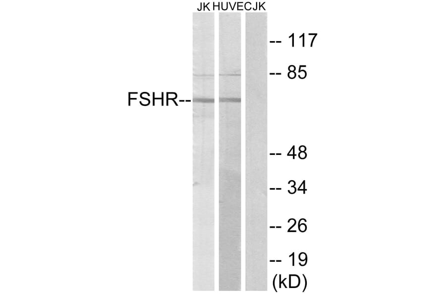 Western Blot - Anti-FSHR Antibody (G253) - Antibodies.com