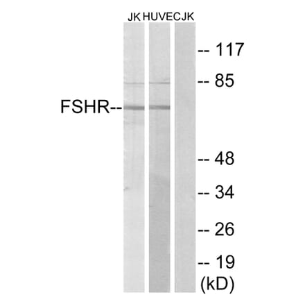 Western Blot - Anti-FSHR Antibody (G253) - Antibodies.com