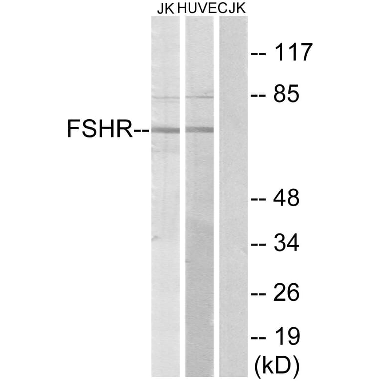 Western Blot - Anti-FSHR Antibody (G253) - Antibodies.com