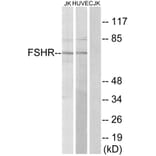 Western Blot - Anti-FSHR Antibody (G253) - Antibodies.com