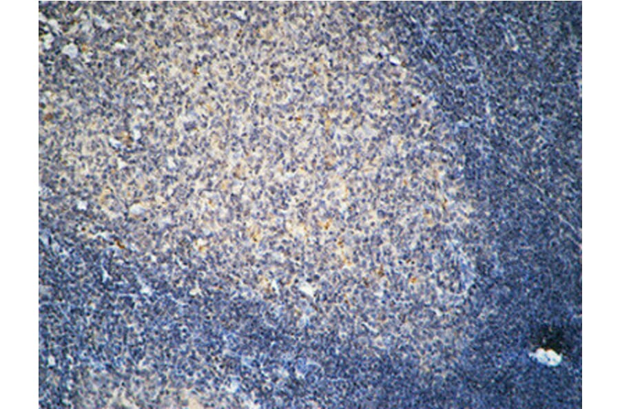 Immunohistochemistry - Anti-FSHR Antibody (G253) - Antibodies.com