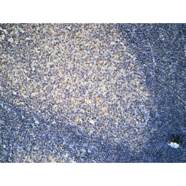 Immunohistochemistry - Anti-FSHR Antibody (G253) - Antibodies.com