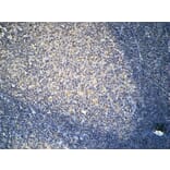 Immunohistochemistry - Anti-FSHR Antibody (G253) - Antibodies.com