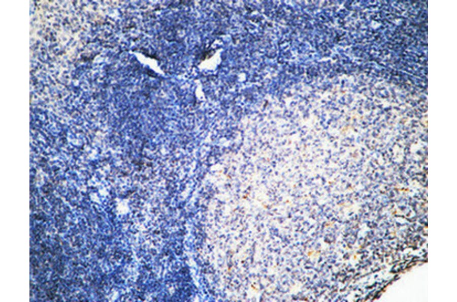 Immunohistochemistry - Anti-FSHR Antibody (G253) - Antibodies.com