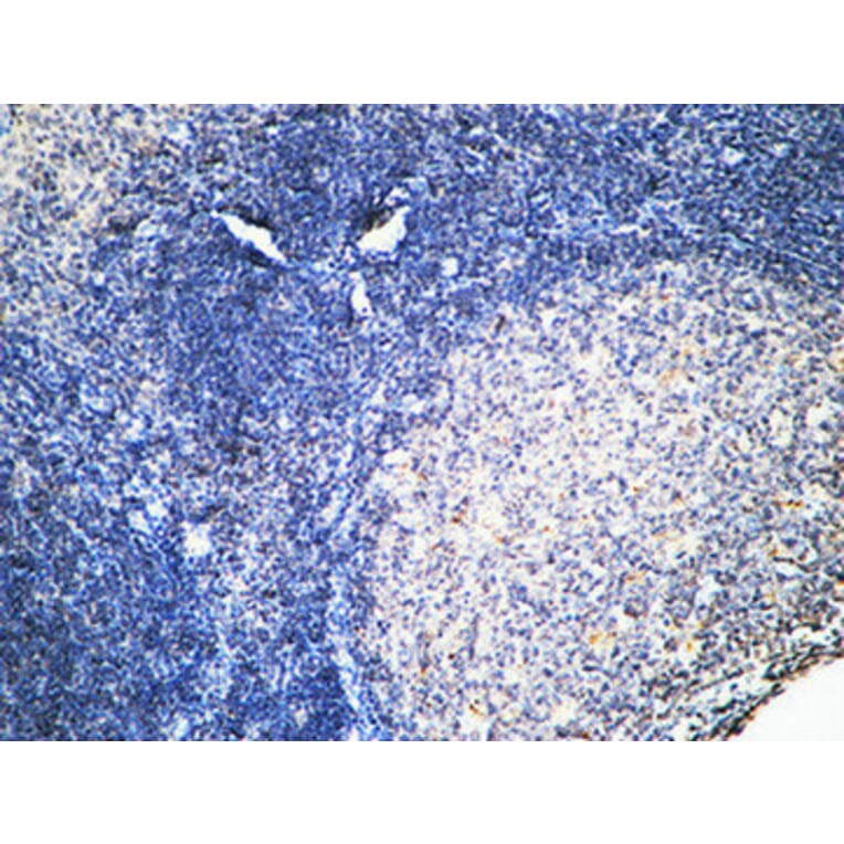 Immunohistochemistry - Anti-FSHR Antibody (G253) - Antibodies.com
