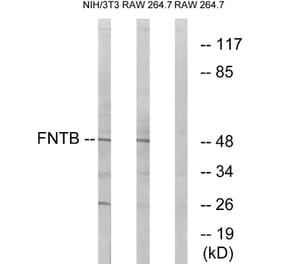 Western Blot - Anti-FNTB Antibody (C17991) - Antibodies.com