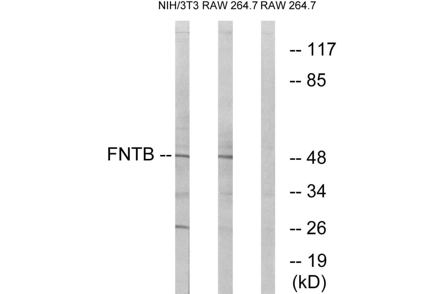 Western Blot - Anti-FNTB Antibody (C17991) - Antibodies.com