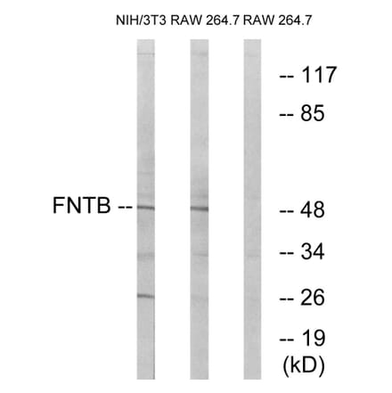 Western Blot - Anti-FNTB Antibody (C17991) - Antibodies.com