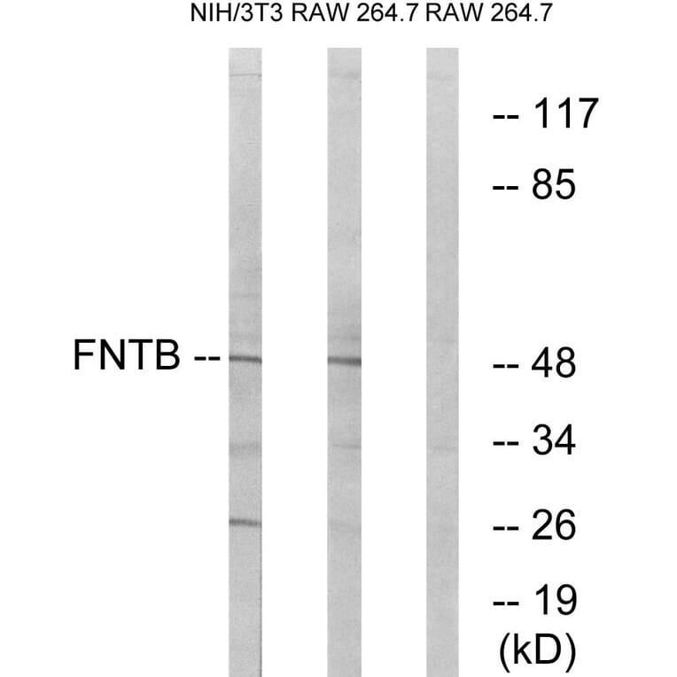 Western Blot - Anti-FNTB Antibody (C17991) - Antibodies.com