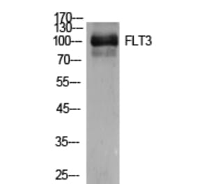 Western Blot - Anti-FLT3 Antibody (C30429) - Antibodies.com