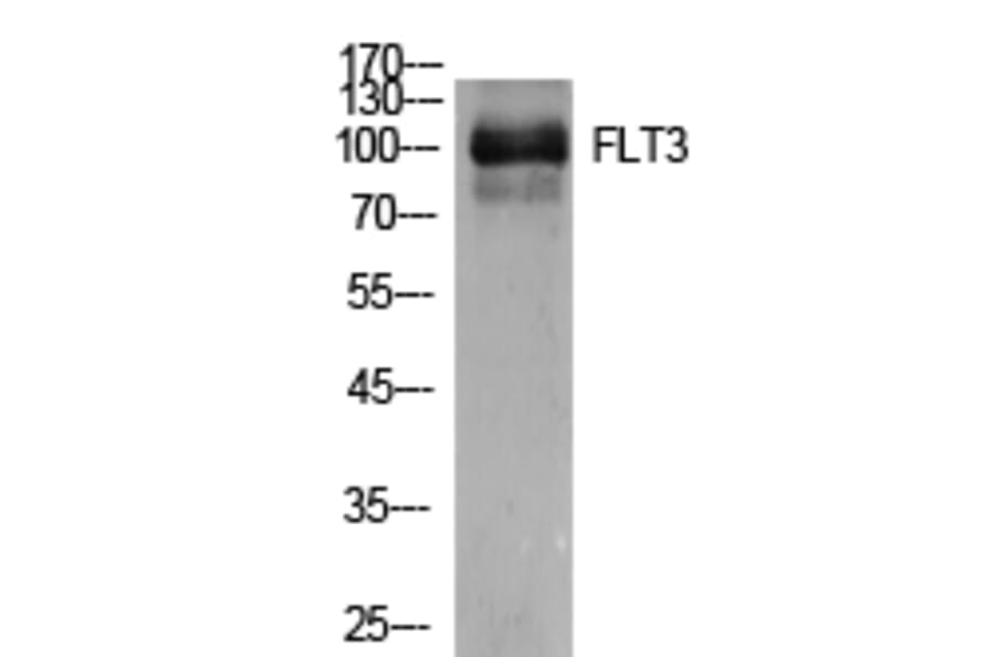 Western Blot - Anti-FLT3 Antibody (C30429) - Antibodies.com