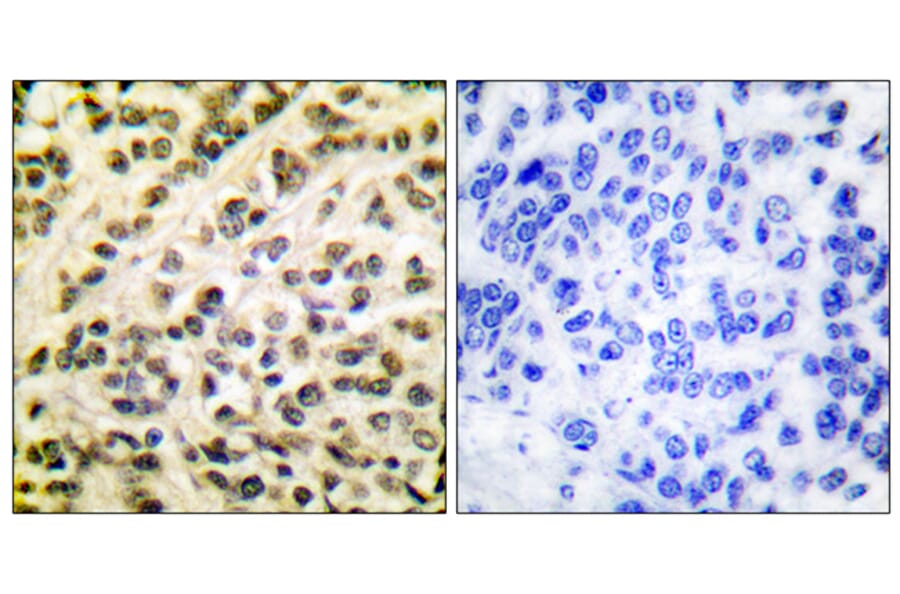 Immunohistochemistry - Anti-FLI1 Antibody (C0196) - Antibodies.com