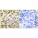 Immunohistochemistry - Anti-FLI1 Antibody (C0196) - Antibodies.com
